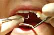 Indian Dentist in US tries to Extract 20 Teeth At Once, Patient Dies: Report